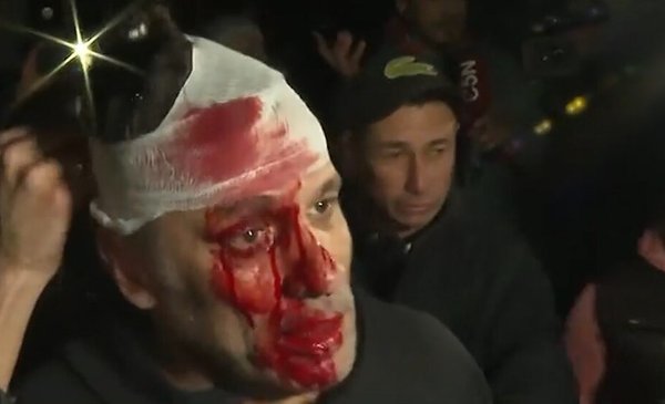 Brutal agresión a periodista de América TV en acto de Milei: lo golpearon y le dejaron el rostro destrozado