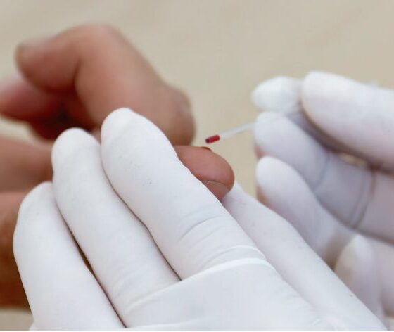 Jornada de testeo gratuito de VIH y Sífilis en Bahía Blanca