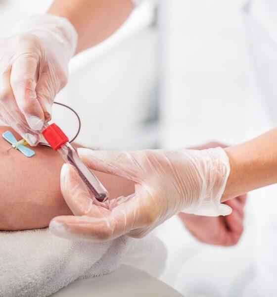 La importancia de los análisis de laboratorio y hacerse controles regularmente