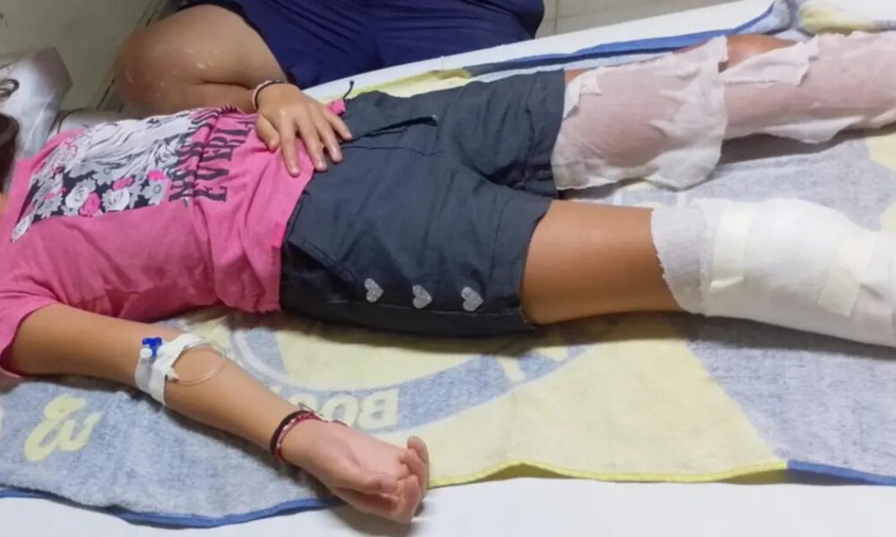 Dos niños de Bahía Blanca encontraron un artefacto en un basural, lo llevaron a su casa y explotó