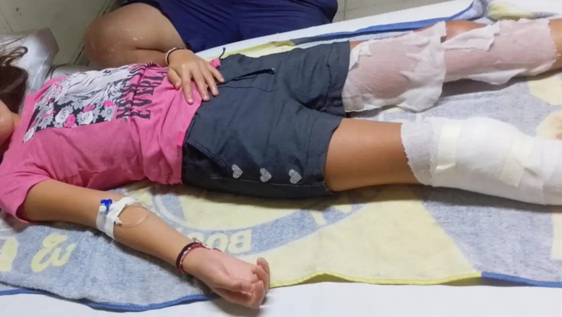 Dos niños de Bahía Blanca encontraron un artefacto en un basural, lo llevaron a su casa y explotó